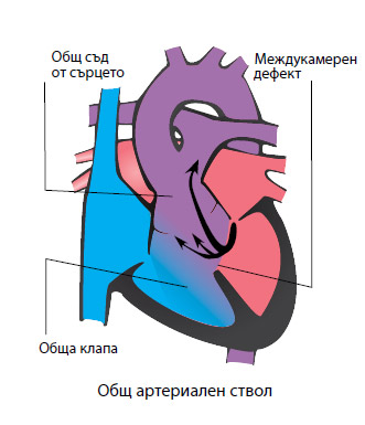 общ артериален ствол